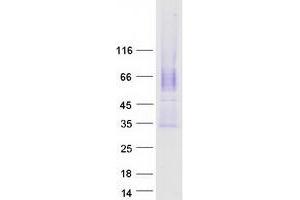 Validation with Western Blot (CACNG5 Protein (Transcript Variant 1) (Myc-DYKDDDDK Tag))