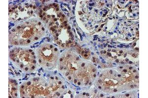 Image no. 3 for anti-Proteasome (Prosome, Macropain) 26S Subunit, Non-ATPase, 2 (PSMD2) antibody (ABIN1500479)