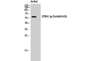 Western Blot (WB) analysis of Jurkat cells using Phospho-4. (EPB41 Antikörper  (pTyr660))