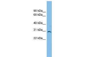 WB Suggested Anti-SNF8 Antibody Titration: 0. (SNF8 Antikörper  (Middle Region))