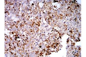Immunohistochemistry (IHC) image for anti-Toll-Like Receptor 9 (TLR9) (AA 868-1016) antibody (ABIN5896728) (TLR9 Antikörper  (AA 868-1016))