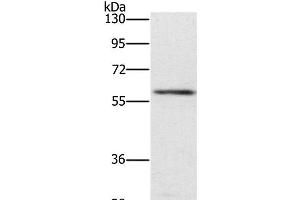 Western Blot analysis of Mouse spleen tissue using TRAFD1 Polyclonal Antibody at dilution of 1:400 (TRAFD1 Antikörper)