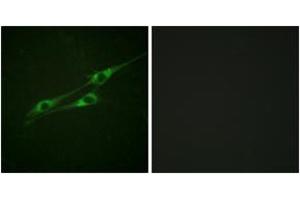 Immunofluorescence analysis of NIH-3T3 cells, using IL-13R/CD213 alpha1 (Ab-405) Antibody. (CD213alpha1 (AA 371-420) Antikörper)