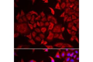 Immunofluorescence analysis of HeLa cells using TARS Polyclonal Antibody (TARS Antikörper)