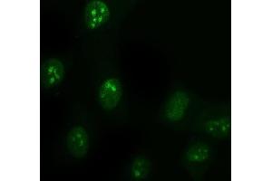 IF analysis of DDX1 using anti-DDX1 antibody (ABIN7602052).