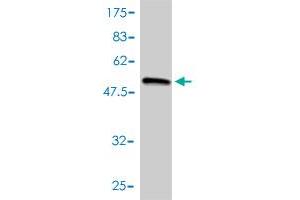 Western Blot detection against Immunogen (55. (COL2A1 Antikörper  (AA 1-268))