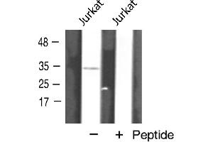 Western blot analysis of AQP12 expression in Jurkat cells (Aquaporin 12A Antikörper  (C-Term))
