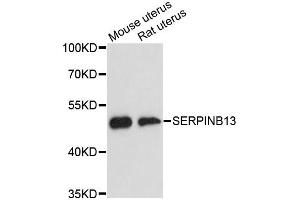Western blot analysis of extracts of various cell lines, using SERPINB13 antibody (ABIN6292723) at 1:3000 dilution. (SERPINB13 Antikörper)