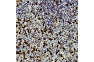 Immunohistochemistry of paraffin-embedded mouse spleen using CD11b/ITGAM antibody (ABIN3022179, ABIN3022180, ABIN3022181 and ABIN6218650) at dilution of 1:100 (40x lens). (CD11b Antikörper  (AA 145-340))