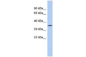 WB Suggested Anti-SIRT4 Antibody Titration:  0. (SIRT4 Antikörper  (N-Term))