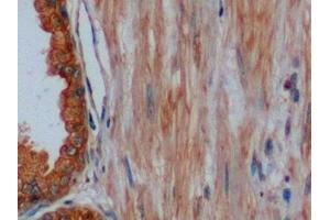 Immunohistochemistry (IHC) image for anti-Keratin 8 (KRT8) (AA 92-393) antibody (ABIN7434548)