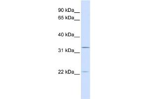 WB Suggested Anti-BRI3BP Antibody Titration:  0.