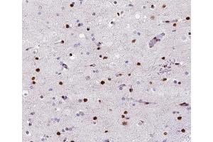 ABIN6266528 at 1/200 staining human brain tissue sections by IHC-P. (POLB Antikörper  (C-Term))