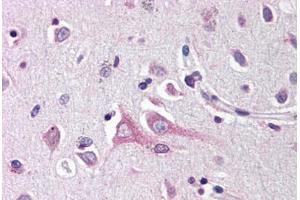 Human Brain, Cortex (formalin-fixed, paraffin-embedded) stained with NRN1 antibody ABIN214458 at 10 ug/ml followed by biotinylated goat anti-rabbit IgG secondary antibody ABIN481713, alkaline phosphatase-streptavidin and chromogen. (NRN1 Antikörper  (Internal Region))