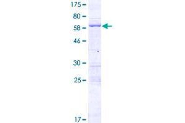 FSD1L Protein (AA 1-311) (GST tag)