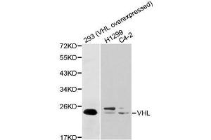 Western blot analysis of extracts of various cell lines, using VHL antibody.