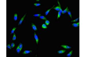 Immunofluorescent analysis of Hela cells using ABIN7149558 at dilution of 1:100 and Alexa Fluor 488-congugated AffiniPure Goat Anti-Rabbit IgG(H+L) (DAPK3 Antikörper  (AA 283-401))