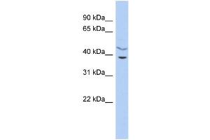 WB Suggested Anti-C11orf77 Antibody Titration: 0. (HARBI1 Antikörper  (Middle Region))