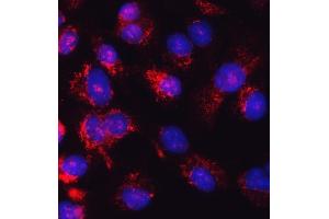 IF analysis of Glutathione Reductase using anti-Glutathione Reductase antibody (ABIN5693151).