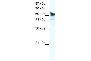 DDX41 antibody used at 1. (DDX41 Antikörper)