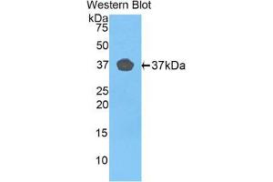 Western blot analysis of the recombinant protein. (FBLN4 Antikörper  (AA 278-366))
