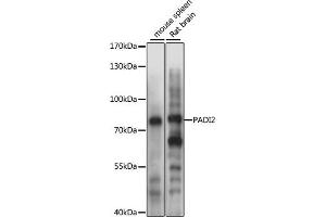 Western blot analysis of extracts of various cell lines, using P antibody (ABIN6128410, ABIN6145163, ABIN6145165 and ABIN6215405) at 1:1000 dilution. (PADI2 Antikörper  (AA 26-210))