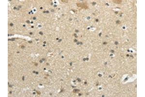 The image on the left is immunohistochemistry of paraffin-embedded Human brain tissue using ABIN7193051(WNK2 Antibody) at dilution 1/35, on the right is treated with synthetic peptide. (WNK2 Antikörper)
