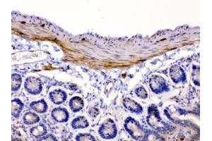 Immunohistochemistry (IHC) image for anti-Cholinergic Receptor, Nicotinic, alpha 5 (Neuronal) (CHRNA5) (AA 44-76) antibody (ABIN5647951)