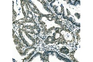 Figure 3 IHC analysis of MSI using anti-MSI antibody (ABIN7603130).