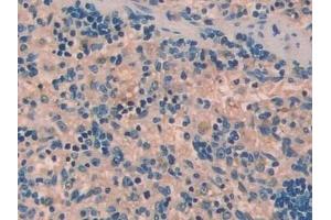 Immunohistochemistry (IHC) image for anti-Urocortin (UCN) (AA 31-121) antibody (ABIN7431422)