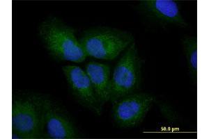 Immunofluorescence of monoclonal antibody to VIM on U-2 OS cell.