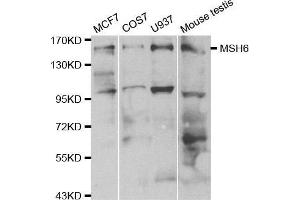 Western blot analysis of extracts of various cell lines, using MSH6 antibody. (MSH6 Antikörper  (AA 1-290))