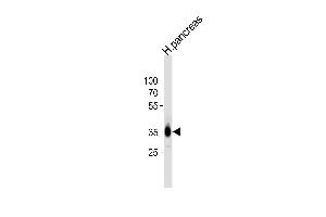 Western blot analysis of lysate from human pancreas tissue lysate, using A Antibody (C-term) 1024c.