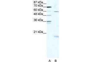 Western Blotting (WB) image for anti-SRY (Sex Determining Region Y)-Box 9 (SOX9) antibody (ABIN2463814) (SOX9 Antikörper)