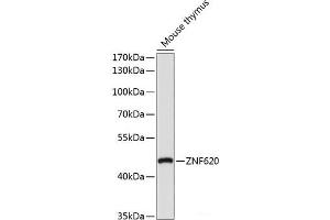Western blot analysis of extracts of Mouse thymus using ZNF620 Polyclonal Antibody at dilution of 1:1000. (ZNF620 Antikörper)