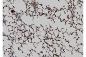 ABIN6264723 and ABIN6276884 at 1/100 staining Mouse lung tissue by IHC-P.