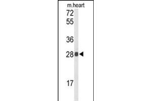 Western blot analysis of TSN1 Antibody (Center) (ABIN652638 and ABIN2842428) in mouse heart tissue lysates (35 μg/lane). (TSPAN1 Antikörper  (AA 140-167))