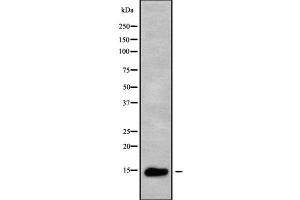 Western blot analysis of ZNRD1 using HuvEc whole cell lysates (ZNRD1 Antikörper  (Internal Region))