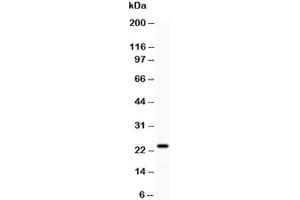 Western blot testing of Claudin-5 antibody and rat liver (Claudin 5 Antikörper  (AA 191-218))