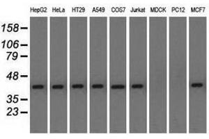 Image no. 3 for anti-Nucleoredoxin-Like 2 (NXNL2) antibody (ABIN1499887) (NXNL2 Antikörper)