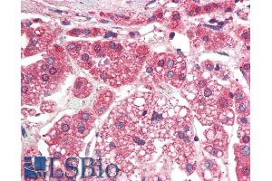 Immunohistochemistry (IHC) image for anti-Transforming Growth Factor, beta Receptor 1 (TGFBR1) (AA 50-63) antibody (ABIN768623)