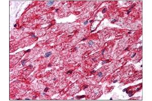 Image no. 1 for anti-Caveolin 1, Caveolae Protein, 22kDa (CAV1) (Internal Region) antibody (ABIN374578) (Caveolin-1 Antikörper  (Internal Region))