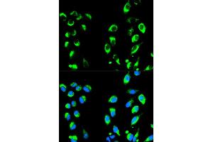 Immunofluorescence analysis of HeLa cells using NFKBIA antibody (ABIN4904527).