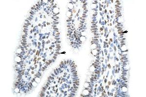 SFPQ antibody was used for immunohistochemistry at a concentration of 4-8 ug/ml to stain Epithelial cells of renal tubule (arrows) in Human Intestine. (SFPQ Antikörper)