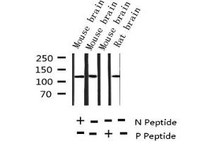 Western Blotting (WB) image for anti-Amyloid beta (A4) Precursor Protein (APP) (pThr668) antibody (ABIN6255723)