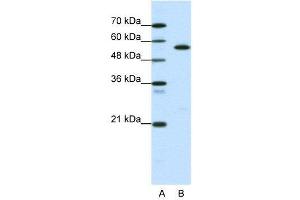 WB Suggested Anti-CORO1A  Antibody Titration: 0. (Coronin 1a Antikörper  (Middle Region))