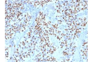 Formalin-fixed, paraffin-embedded human Lymph Node stained with Oct-2 Mouse Monoclonal Antibody (OCT2/2136).