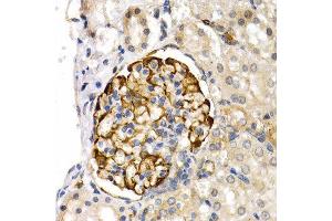 Immunohistochemistry (IHC) image for anti-Lipase, Endothelial (LIPG) (AA 251-500) antibody (ABIN6219026) (LIPG Antikörper  (AA 251-500))