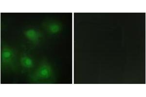 Immunofluorescence analysis of HeLa cells, using CDK2 Antibody. (CDK2 Antikörper  (AA 231-280))