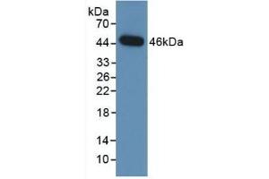 Detection of Recombinant NEU, Human using Monoclonal Antibody to Neuraminidase (NEU) (NEU1 Antikörper  (AA 47-415))